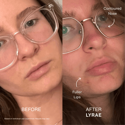 Contour Pulse - Side Profile