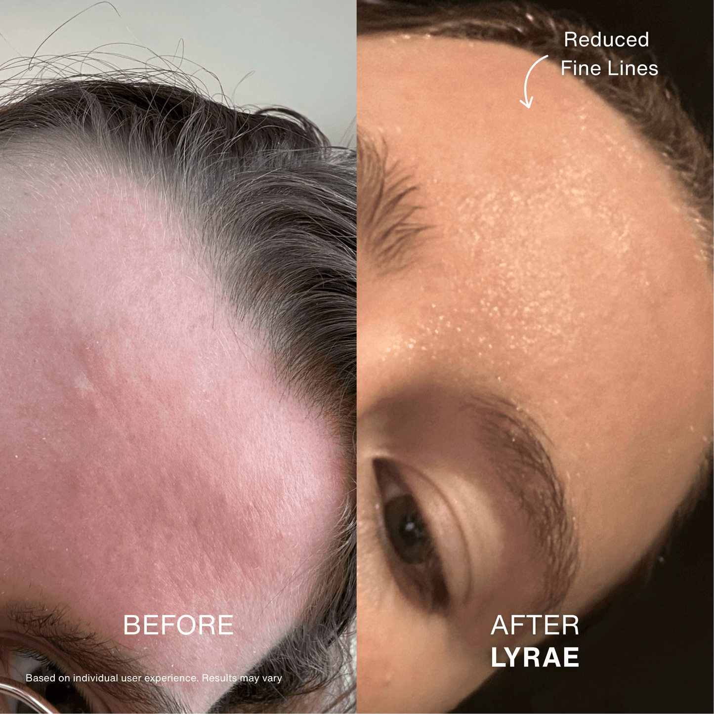 Contour Pulse - Side Profile