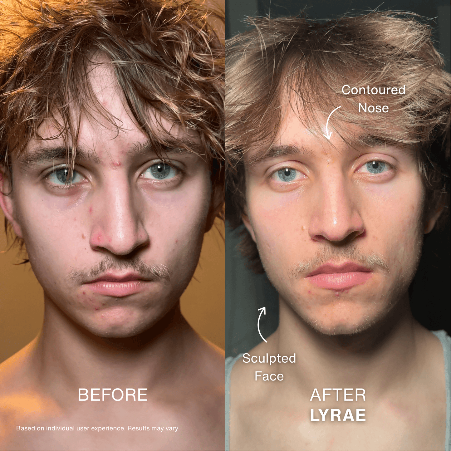 Contour Pulse Sculpting Treatment