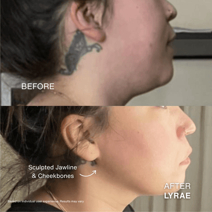 Contour Pulse - Side Profile